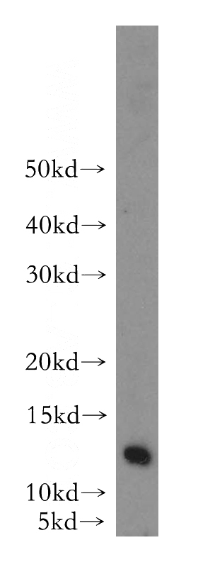 HeLa cells were subjected to SDS PAGE followed by western blot with Catalog No:112351(LSM7 antibody) at dilution of 1:1000