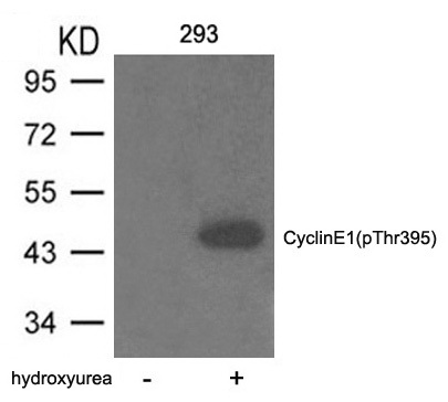 Western blot analysis of extracts from 293 cells untreated or treated with hydroxyurea using Cyclin E1 (phospho-Thr395) Antibody .