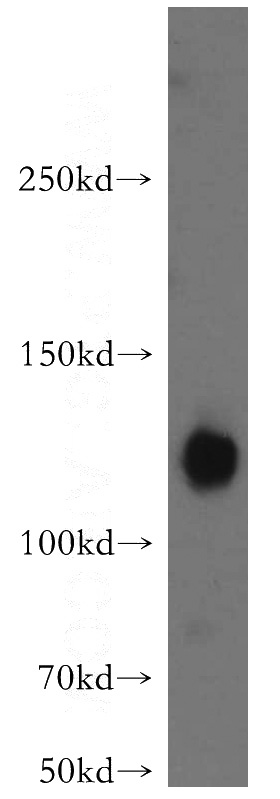 mouse brain tissue were subjected to SDS PAGE followed by western blot with Catalog No:108317(ATP8A1 antibody) at dilution of 1:500