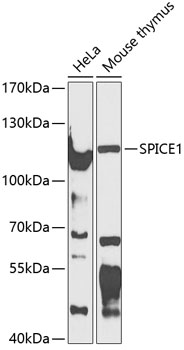Western blot - CCDC52 Polyclonal Antibody 