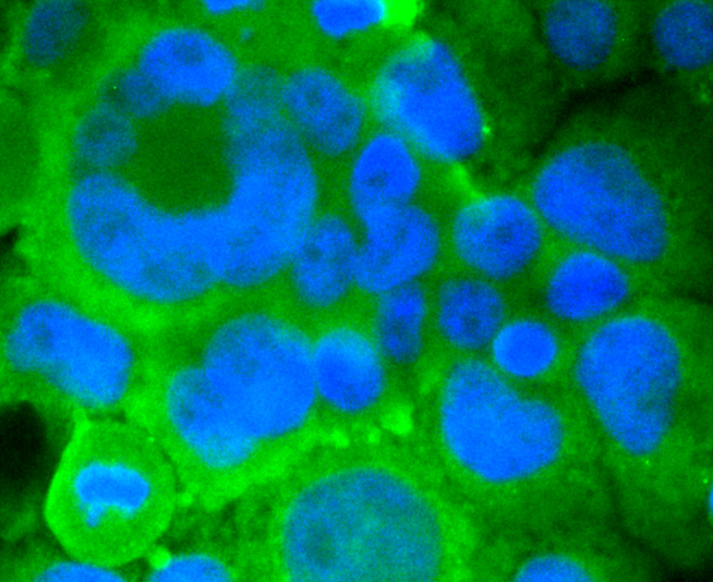Immunofluorescence - GRM5 Monoclonal Antibody 