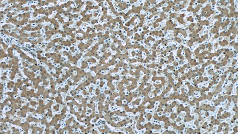 Immunohistochemistry of paraffin-embedded human liver slide using Catalog No:107033(CASP8 Antibody) at dilution of 1:50