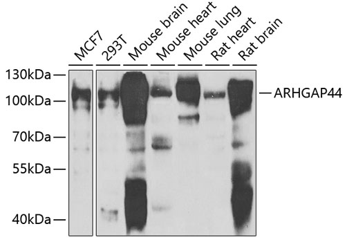 Western blot - ARHGAP44 Polyclonal Antibody 