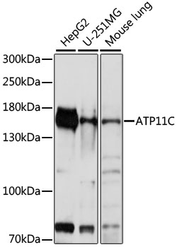 Western blot - ATP11C Polyclonal Antibody 