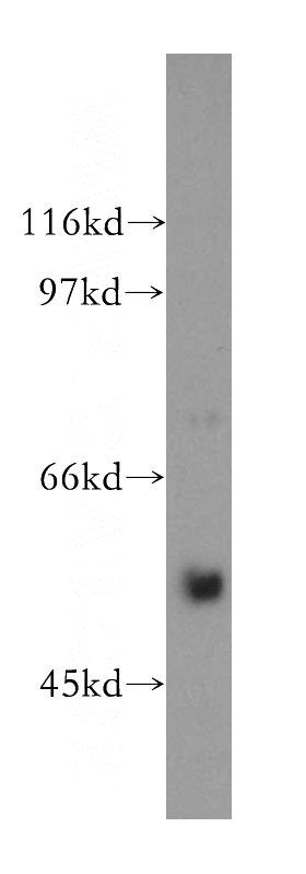 human brain tissue were subjected to SDS PAGE followed by western blot with Catalog No:112250(LMAN1 antibody) at dilution of 1:400