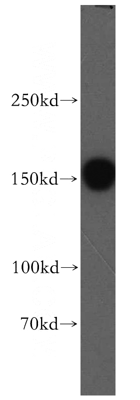human brain tissue were subjected to SDS PAGE followed by western blot with Catalog No:116797(VPS8 antibody) at dilution of 1:500