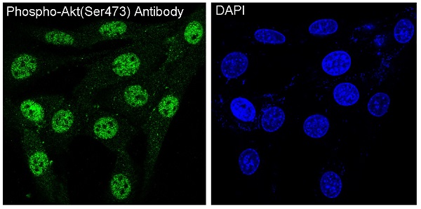 Immunofluorescent analysis of NIH/3T3 cells treated with PDGF, using Phospho-Akt(Ser473) Antibody.