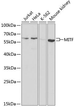 Western blot - MITF Polyclonal Antibody 