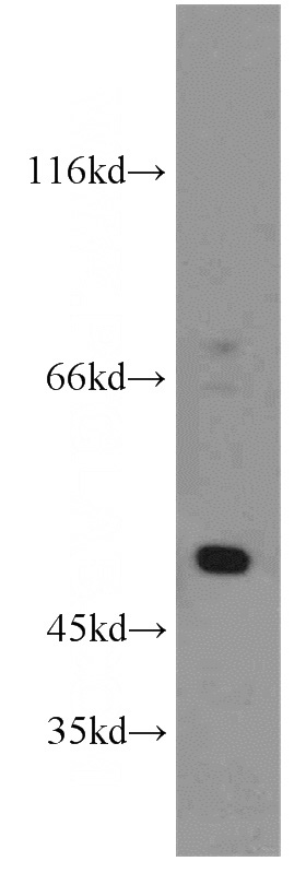 HeLa cells were subjected to SDS PAGE followed by western blot with Catalog No:115216(SESN3 antibody) at dilution of 1:500