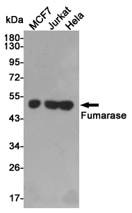 Western blot detection of Fumarase in MCF7,Jurkat and Hela cell lysates using Fumarase mouse mAb (1:3000 diluted).Predicted band size:50kDa.Observed band size:50kDa.