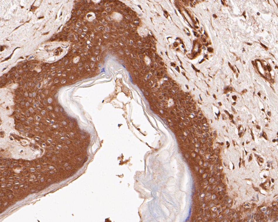 Fig3: Immunohistochemical analysis of paraffin-embedded human skin tissue using anti-SPATIAL antibody. The section was pre-treated using heat mediated antigen retrieval with Tris-EDTA buffer (pH 8.0-8.4) for 20 minutes.The tissues were blocked in 5% BSA for 30 minutes at room temperature, washed with ddH2O and PBS, and then probed with the primary antibody ( 1/50) for 30 minutes at room temperature. The detection was performed using an HRP conjugated compact polymer system. DAB was used as the chromogen. Tissues were counterstained with hematoxylin and mounted with DPX.