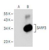 Fig1: Western blot analysis of SARP3 expression in non-transfected (A) and human SARP3 transfected (B) 293T whole cell lysates.