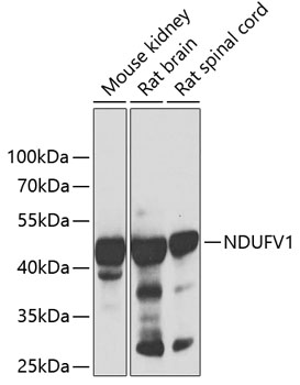 Western blot - NDUFV1 Polyclonal Antibody 