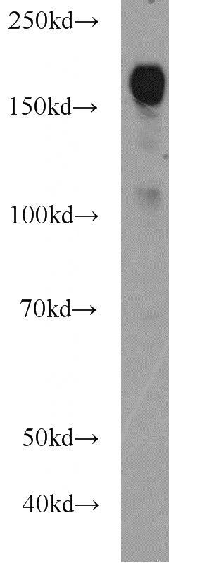 MCF7 cells were subjected to SDS PAGE followed by western blot with Catalog No:110401(ERBB2IP antibody) at dilution of 1:1000