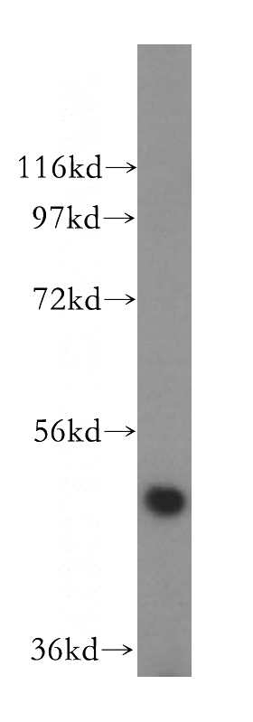 Jurkat cells were subjected to SDS PAGE followed by western blot with Catalog No:112617(MIER2 antibody) at dilution of 1:500