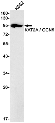 Western blot detection of KAT2A / GCN5 in K562 cell lysates using KAT2A / GCN5 Rabbit pAb(1:1000 diluted).Predicted band size:94kDa.Observed band size:94kDa.