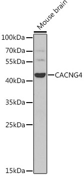 Western blot - CACNG4 Polyclonal Antibody 
