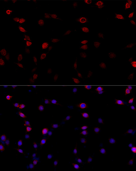 Immunofluorescence - ATP5B Polyclonal Antibody 