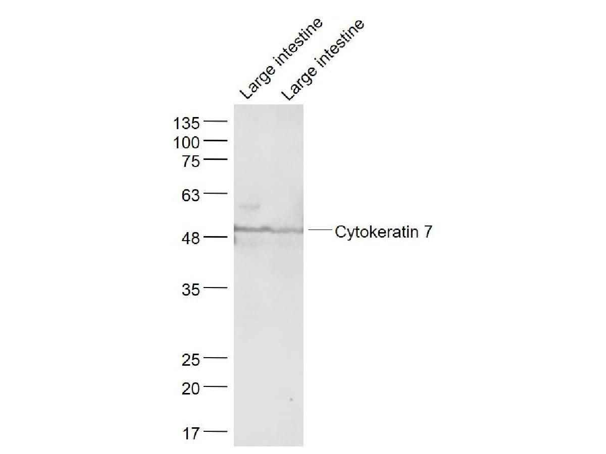 Fig1: Sample:; Large intestine (Mouse) Lysate at 40 ug; Large intestine(Rat) Lysate at 40 ug; Primary: Anti- Cytokeratin 7 at 1/1000 dilution; Secondary: IRDye800CW Goat Anti-Rabbit IgG at 1/20000 dilution; Predicted band size: 54 kD; Observed band size: 54 kD