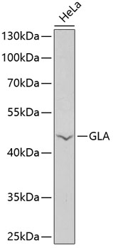 Western blot - GLA Polyclonal Antibody 