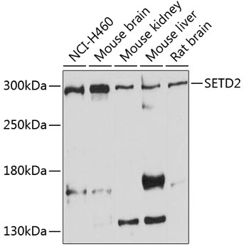 Western blot - SETD2 Polyclonal Antibody 