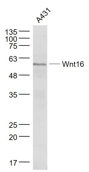 Fig1: Sample:; A431(Human) Cell Lysate at 30 ug; Primary: Anti- Wnt16 at 1/1000 dilution; Secondary: IRDye800CW Goat Anti-Rabbit IgG at 1/20000 dilution; Predicted band size: 37 kD; Observed band size: 56 kD