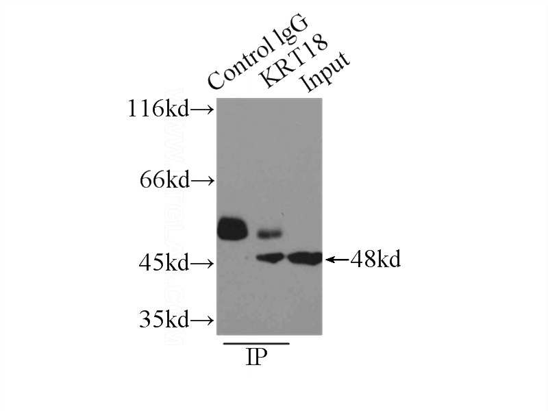 IP Result of anti-KRT18 (IP:Catalog No:109800, 3ug; Detection:Catalog No:109800 1:2000) with A431 cells lysate 3300ug.