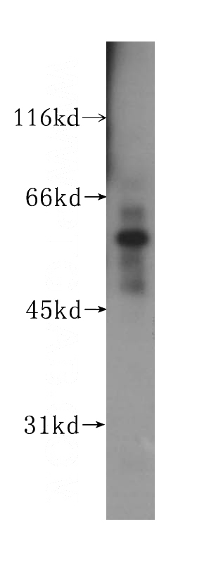 human heart tissue were subjected to SDS PAGE followed by western blot with Catalog No:115933(TEAD3 antibody) at dilution of 1:500