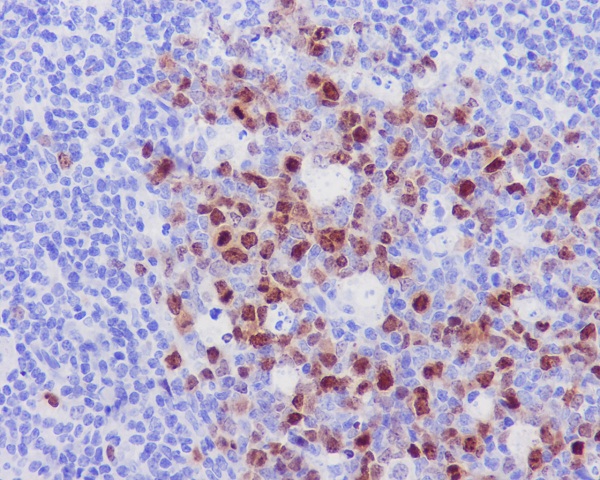 Immunohistochemical analysis of paraffin-embedded human tonsil, using Aurora B Antibody.