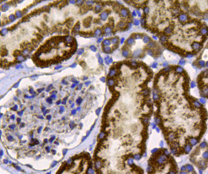 Fig6: Immunohistochemical analysis of paraffin-embedded human kidney tissue using anti-FGFR2 antibody. Counter stained with hematoxylin.