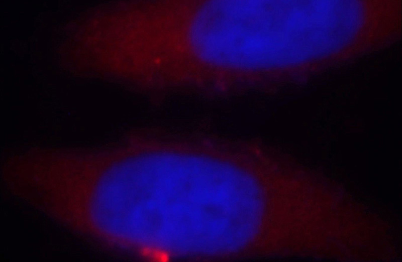 Immunofluorescent analysis of MCF-7 cells, using TARS antibody Catalog No:115853 at 1:25 dilution and Rhodamine-labeled goat anti-rabbit IgG (red). Blue pseudocolor = DAPI (fluorescent DNA dye).