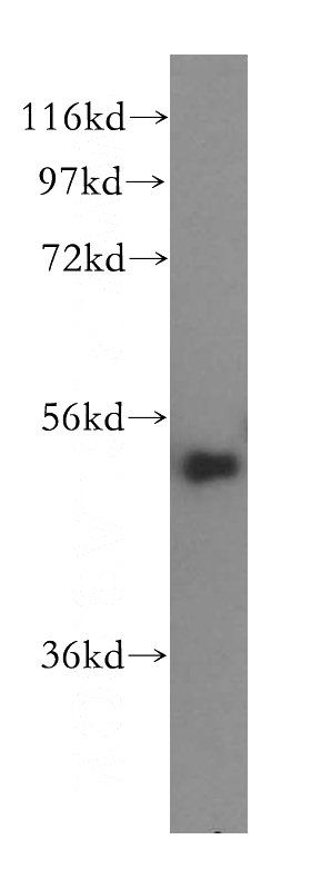 HepG2 cells were subjected to SDS PAGE followed by western blot with Catalog No:115026(SDCCAG10 antibody) at dilution of 1:500