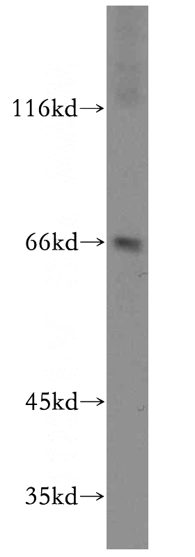 mouse lung tissue were subjected to SDS PAGE followed by western blot with Catalog No:114870(RUFY2 antibody) at dilution of 1:1000