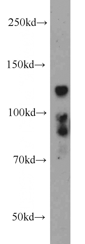 mouse brain tissue were subjected to SDS PAGE followed by western blot with Catalog No:117203(BMPR2 antibody) at dilution of 1:1000