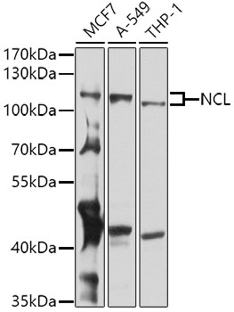Western blot - NCL Polyclonal Antibody 