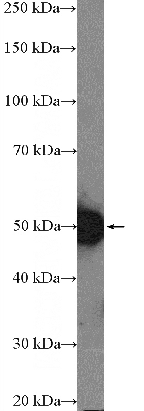 COLO 320 cells were subjected to SDS PAGE followed by western blot with Catalog No:114558(RBMY1A1 Antibody) at dilution of 1:300
