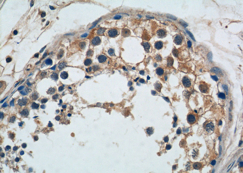 Immunohistochemistry of paraffin-embedded human testis tissue slide using Catalog No:116120(TICAM2 Antibody) at dilution of 1:50 (under 40x lens)