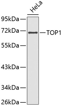 Western blot - TOP1 Polyclonal Antibody 