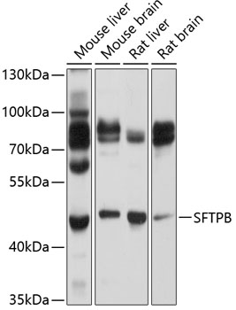 Western blot - SFTPB Polyclonal Antibody 