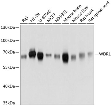 Western blot - WDR1 Polyclonal Antibody 