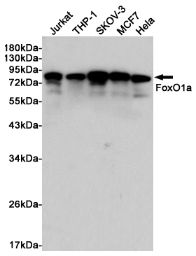 Western blot detection of FoxO1a in Jurkat, THP-1, SKOV-3, MCF7 and Hela cell lysates using FoxO1a rabbit pAb (1:1000 diluted).Predicted band size:70kDa.Observed band size:78 to 82kDa.
