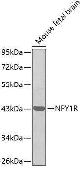 Western blot - NPY1R Polyclonal Antibody 