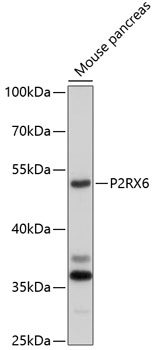 Western blot - P2RX6 Polyclonal Antibody 