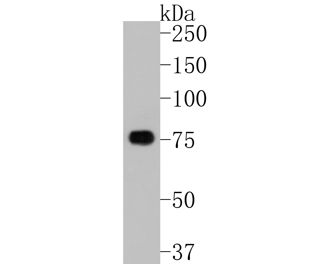 Fig1:; Western blot analysis of TBR1 on rat brain tissue lysates. Proteins were transferred to a PVDF membrane and blocked with 5% BSA in PBS for 1 hour at room temperature. The primary antibody ( 1/500) was used in 5% BSA at room temperature for 2 hours. Goat Anti-Rabbit IgG - HRP Secondary Antibody (HA1001) at 1:200,000 dilution was used for 1 hour at room temperature.