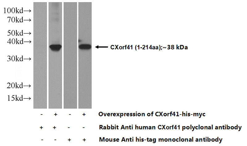 Transfected HEK-293 cells were subjected to SDS PAGE followed by western blot with Catalog No:109651(CXorf41 Antibody) at dilution of 1:500