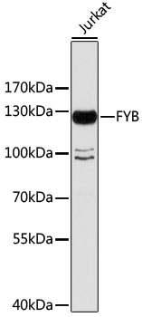 Western blot - FYB Polyclonal Antibody 