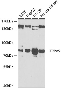 Western blot - TRPV5 Polyclonal Antibody 