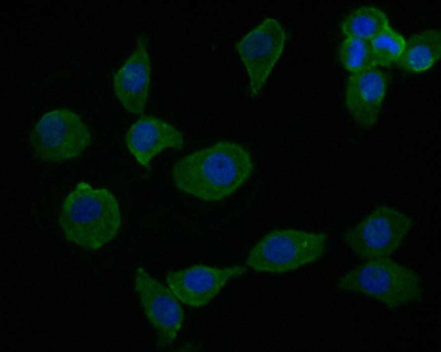 Fig4:; ICC staining of cGAS in SKOV-3 cells (green). Formalin fixed cells were permeabilized with 0.1% Triton X-100 in TBS for 10 minutes at room temperature and blocked with 1% Blocker BSA for 15 minutes at room temperature. Cells were probed with the primary antibody ( 1/100) for 1 hour at room temperature, washed with PBS. Alexa Fluor®488 Goat anti-Rabbit IgG was used as the secondary antibody at 1/1,000 dilution. The nuclear counter stain is DAPI (blue).