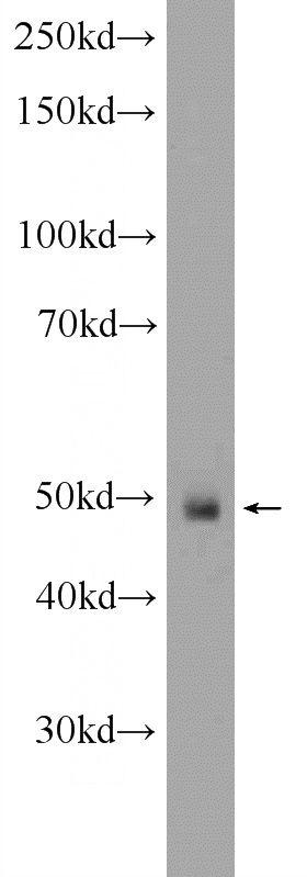 Y79 cells were subjected to SDS PAGE followed by western blot with Catalog No:108075(ANKRD33 Antibody) at dilution of 1:600