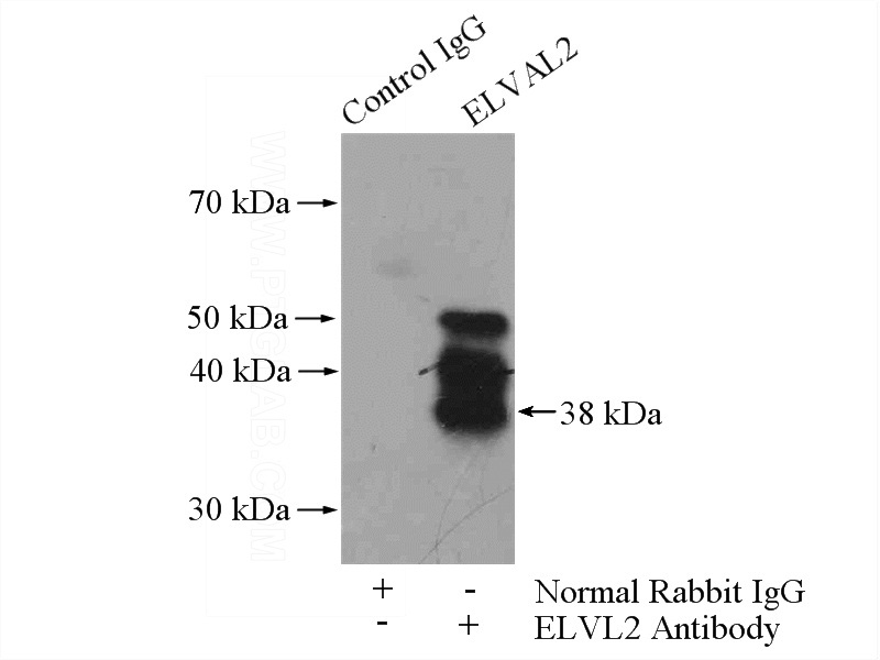 IP Result of anti-ELAVL2 (IP:Catalog No:110273, 4ug; Detection:Catalog No:110273 1:1000) with mouse cerebellum tissue lysate 4400ug.